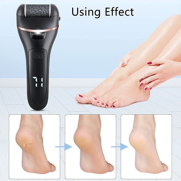 Electric Foot File Pedicure Set