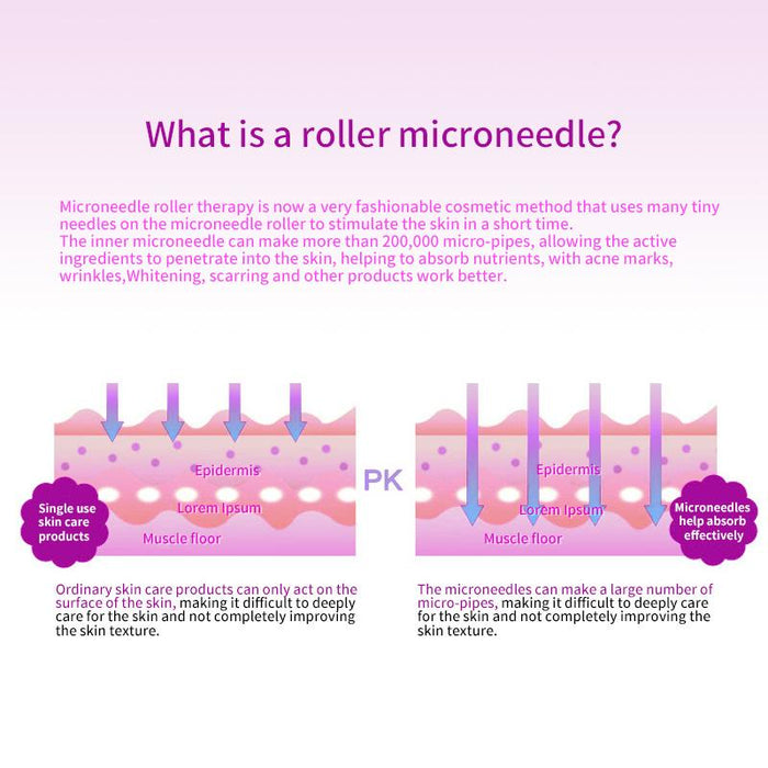 540 Microneedle Scar Derma Roller 0.3mm