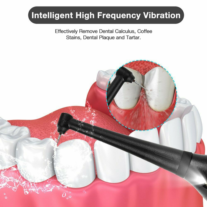 Electric Dental Calculus Remover Tooth Cleaner