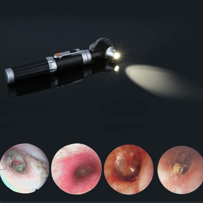 Magnification Ear Scope with LED Direct Illumination Light